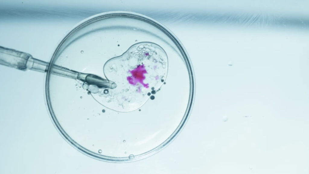 IVF